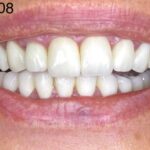 fogpótlás fogászat